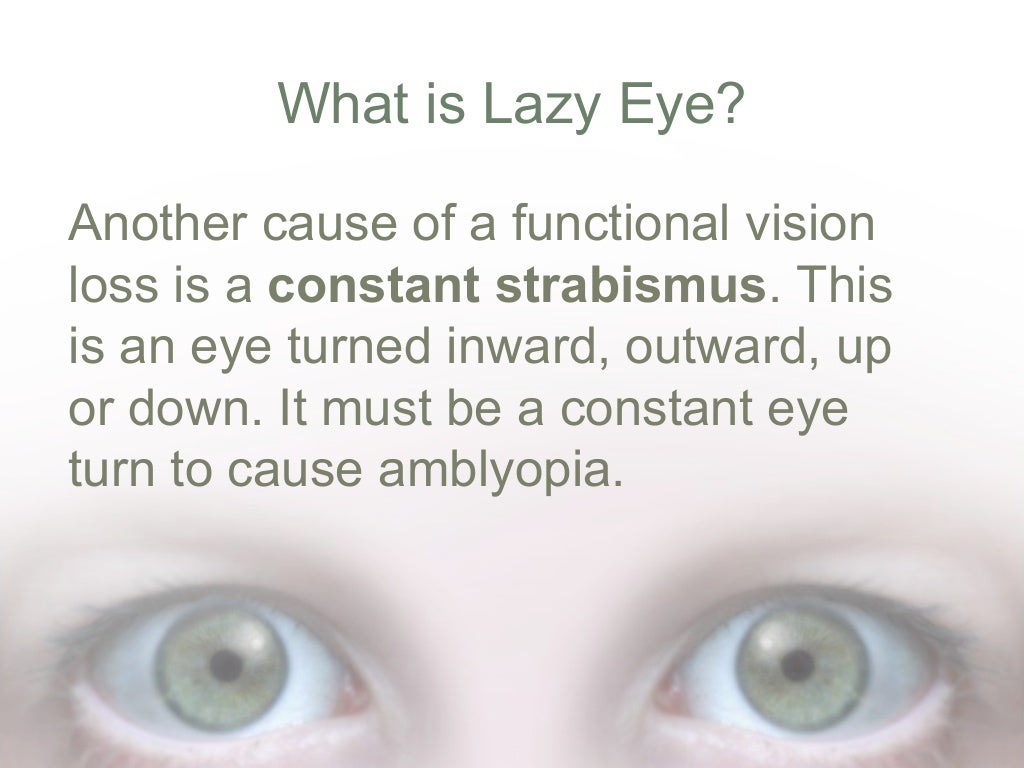 Lay Eye What Is Lazy Eyesight? _ Amblyopia: What Is Lazy Eye? – KPOLM