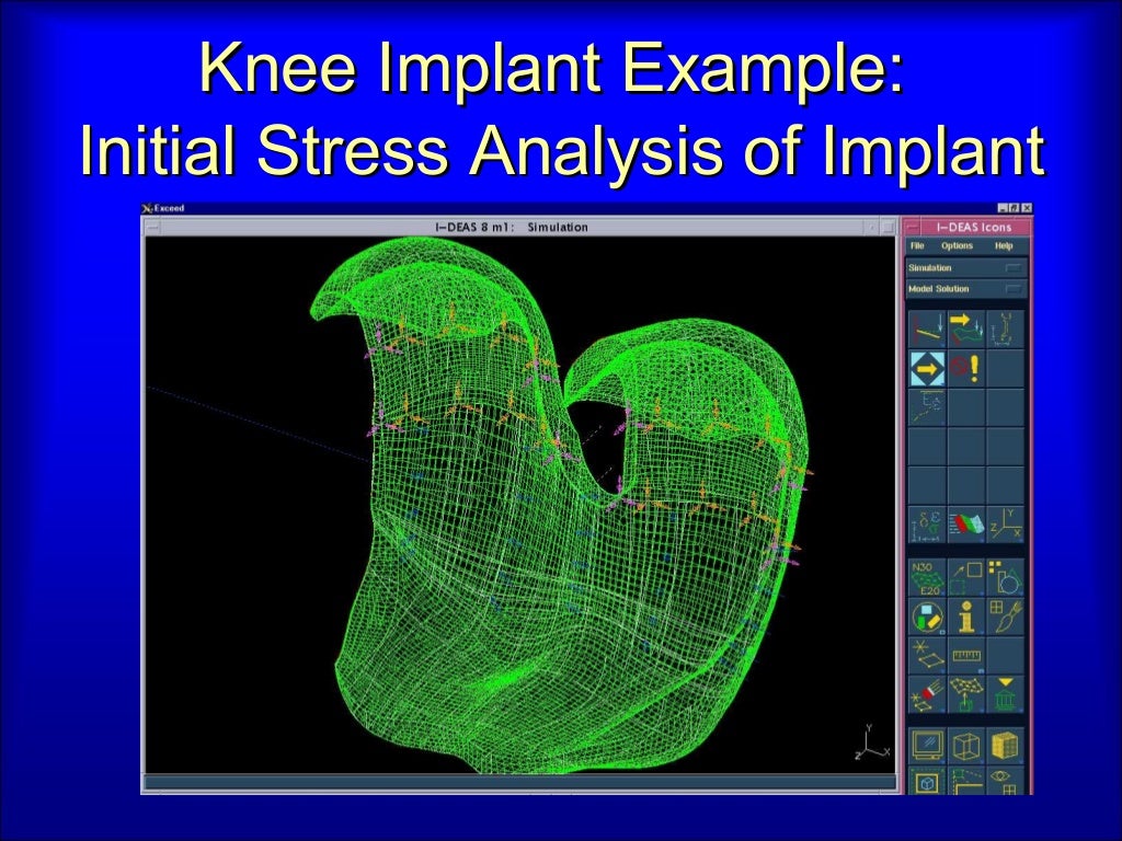 What is machine design