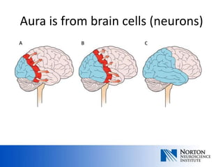 Aura is from brain cells (neurons)
 