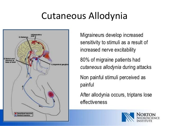 Symptoms Of Allodynia: What Is Allodynia – SZCA