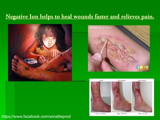 Negative Ion helps to heal wounds faster and relieves pain.




https://www.facebook.com/winaliteprod
 
