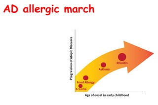 What is new in general pediatrics, allergic and respiratory diseases | PPTX