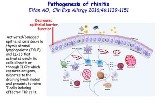 Impaired barrier function in patients with house dust
mite–induced allergic rhinitis is accompanied by decreased
occludin ...