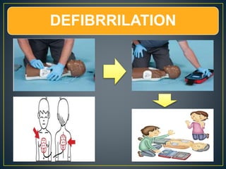 DEFIBRRILATION
 