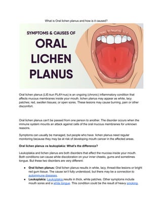 What is Oral lichen planus and how is it caused?
Oral lichen planus (LIE-kun PLAY-nus) is an ongoing (chronic) inflammatory condition that
affects mucous membranes inside your mouth. lichen planus may appear as white, lacy
patches; red, swollen tissues; or open sores. These lesions may cause burning, pain or other
discomfort.
Oral lichen planus can't be passed from one person to another. The disorder occurs when the
immune system mounts an attack against cells of the oral mucous membranes for unknown
reasons.
Symptoms can usually be managed, but people who have lichen planus need regular
monitoring because they may be at risk of developing mouth cancer in the affected areas.
Oral lichen planus vs leukoplakia: What’s the difference?
Leukoplakia and lichen planus are both disorders that affect the mucosa inside your mouth.
Both conditions can cause white discoloration on your inner cheeks, gums and sometimes
tongue. But these two disorders are very different:
● Oral lichen planus: Oral lichen planus results in white, lacy, thread-like lesions or bright
red gum tissue. The cause isn’t fully understood, but there may be a connection to
autoimmune diseases.
● Leukoplakia: Leukoplakia results in thick, white patches. Other symptoms include
mouth sores and a white tongue. This condition could be the result of heavy smoking,
 