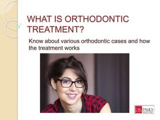 WHAT IS ORTHODONTIC
TREATMENT?
Know about various orthodontic cases and how
the treatment works
 