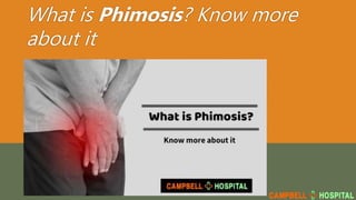 What is Phimosis? Know more
about it
 