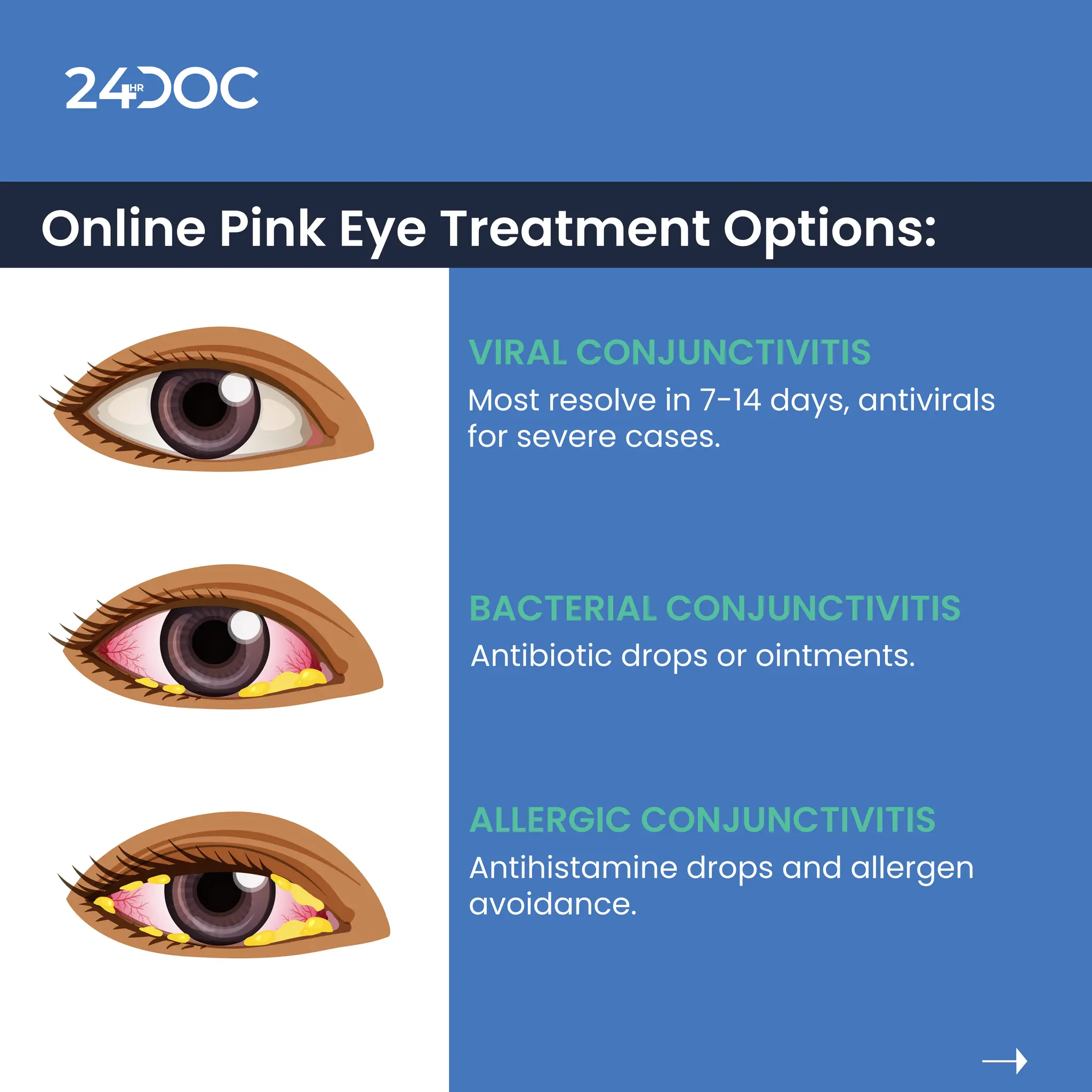 what is pink eye | PDF