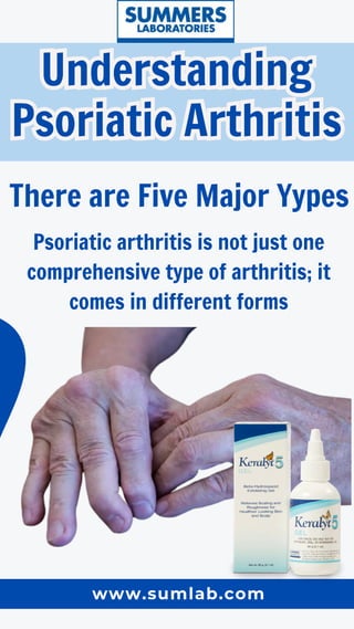 What are the warning signs of psoriatic arthritis? | PDF