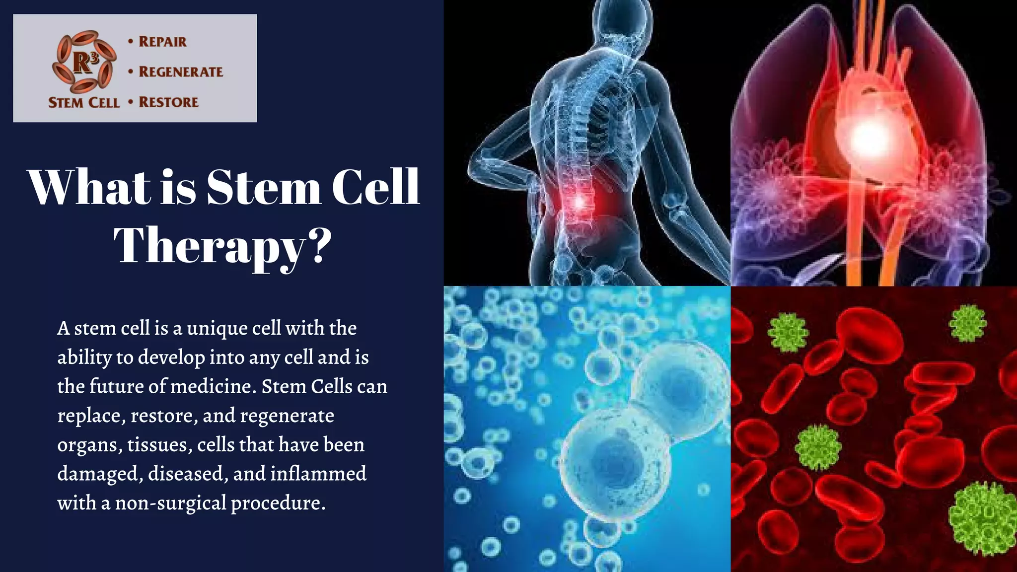 What is R3 stem cell therapy - David Greene, M.D..pdf