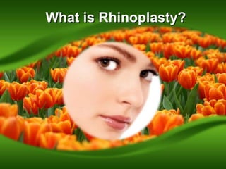 What is Rhinoplasty?
 