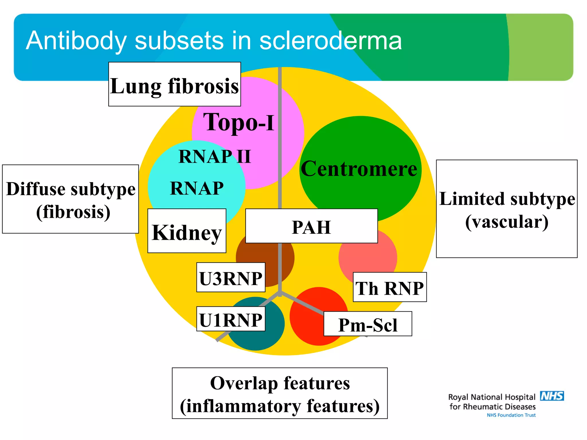 Antibody subsets in scleroderma
RNAP
Topo-I
Centromere
Lung fibrosis
Diffuse subtype
(fibrosis)
Limited subtype
(vascular)
Overlap features
(inflammatory features)
Kidney
Th RNP
RNAP II
U3RNP
U1RNP Pm-Scl
PAH
 