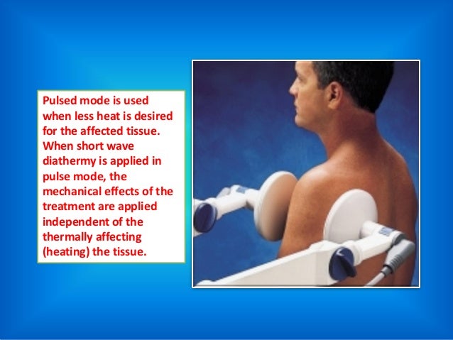 What Is Short Wave Diathermy? What Is Short Wave Diathermy?
