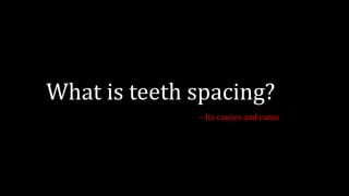 What is teeth spacing?
– Its causes and cures
 