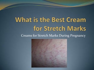 Creams for Stretch Marks During Pregnancy
 