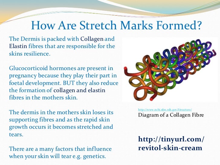 what is the best cream for stretch marks how do stretch marks form