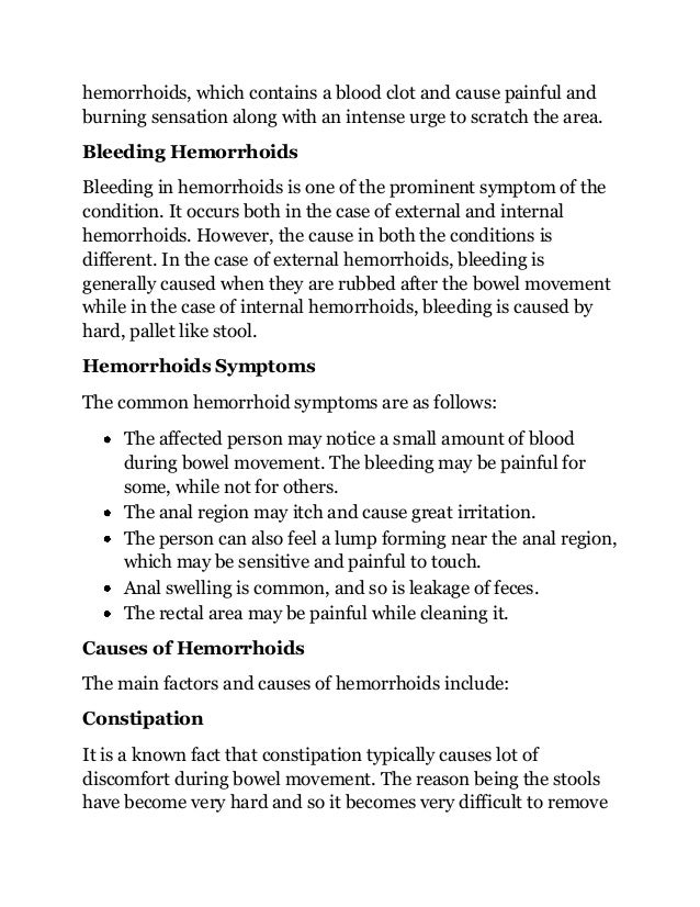 What is the best over the counter treatment for hemorrhoid