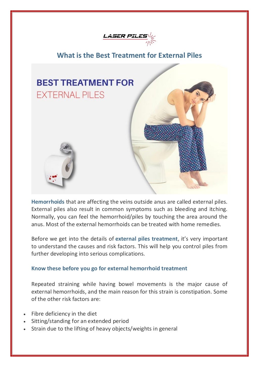 What is the best treatment for external piles