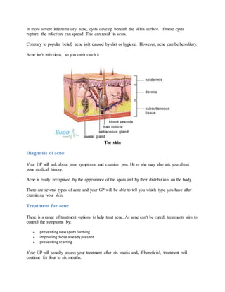 In more severe inflammatory acne, cysts develop beneath the skin's surface. If these cysts
rupture, the infection can spread. This can result in scars.
Contrary to popular belief, acne isn't caused by diet or hygiene. However, acne can be hereditary.
Acne isn't infectious, so you can't catch it.
The skin
Diagnosis of acne
Your GP will ask about your symptoms and examine you. He or she may also ask you about
your medical history.
Acne is easily recognised by the appearance of the spots and by their distribution on the body.
There are several types of acne and your GP will be able to tell you which type you have after
examining your skin.
Treatment for acne
There is a range of treatment options to help treat acne. As acne can't be cured, treatments aim to
control the symptoms by:
 preventingnew spotsforming
 improvingthose alreadypresent
 preventingscarring
Your GP will usually assess your treatment after six weeks and, if beneficial, treatment will
continue for four to six months.
 