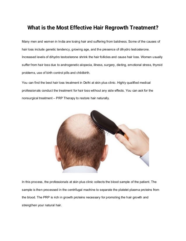 What Is The Most Effective Hair Regrowth Treatment
