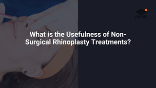 What is the Usefulness of Non-
Surgical Rhinoplasty Treatments?
 