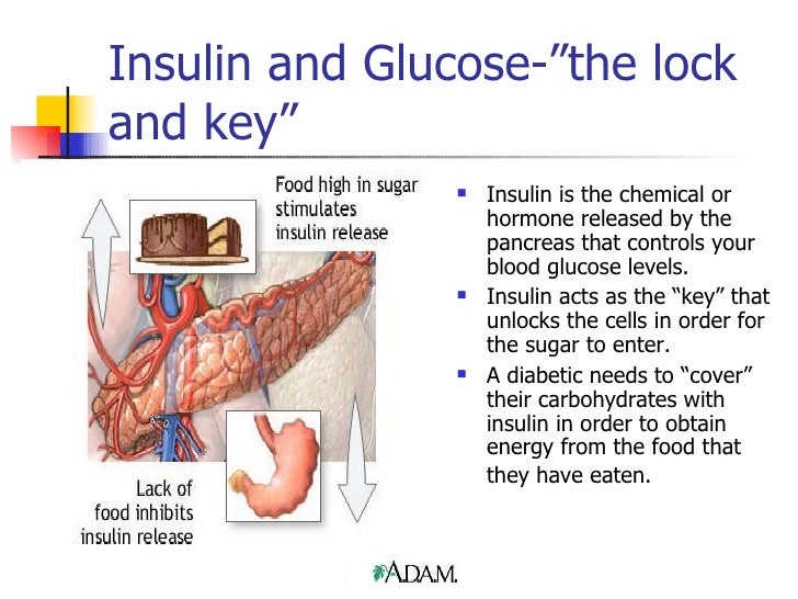What Is Type 1 Diabetes Revised