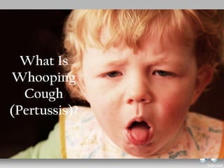 What Is
Whooping
Cough
(Pertussis)?
 