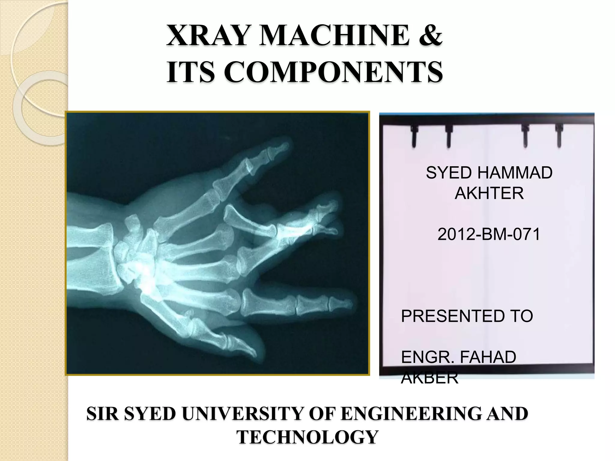 What Is Xray On Amazon Prime - jkxn0t6