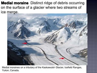 Medial moraine Distinct ridge of debris occurring
on the surface of a glacier where two streams of
ice merge.
Medial moraines on a tributary of the Kaskawulsh Glacier, Icefield Ranges,
Yukon, Canada.
 