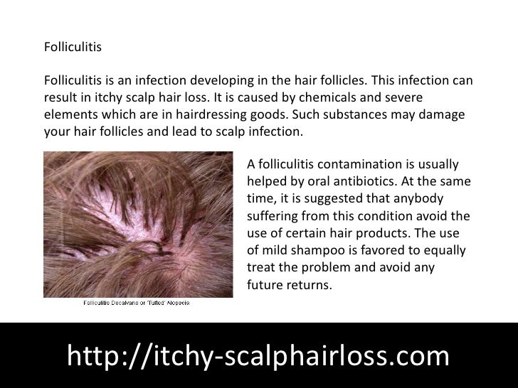 Common Causes Of Hair Loss Healthprep Com
