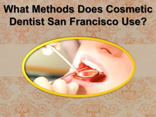 What Methods Does Cosmetic
 Dentist San Francisco Use?
 