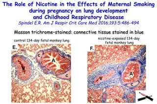 The Role of Nicotine in the Effects of Maternal Smoking
during pregnancy on lung development
and Childhood Respiratory Dis...