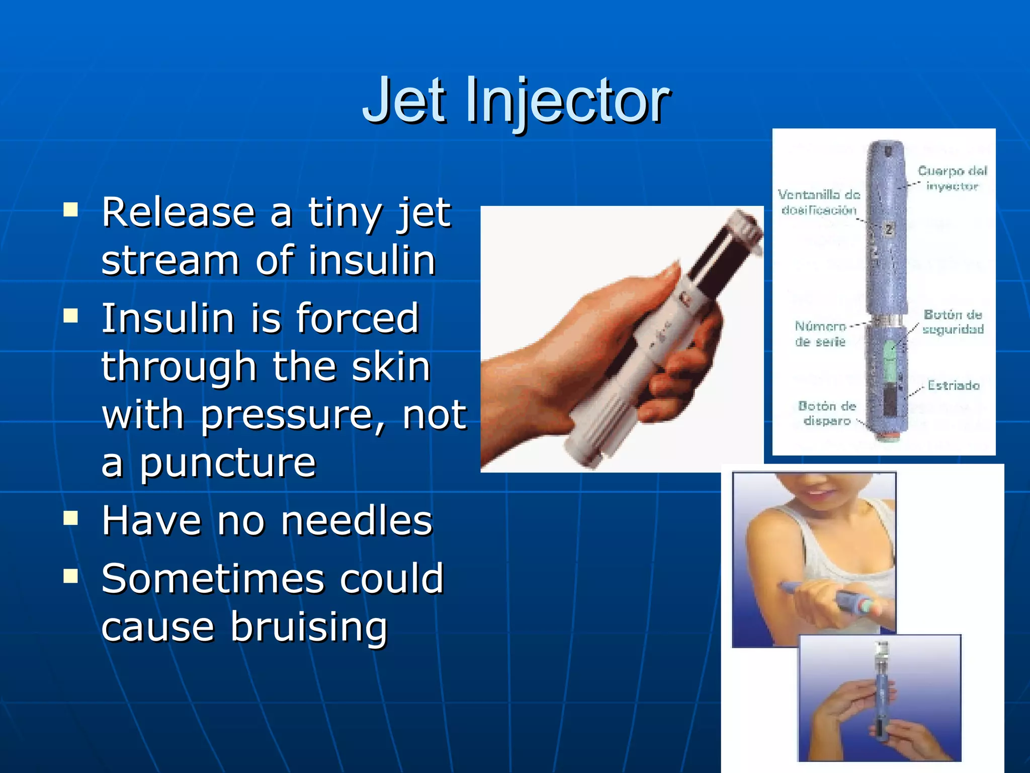 Jet Injector Release a tiny jet stream of insulin Insulin is forced through the skin with pressure, not a puncture Have no needles Sometimes could cause bruising 