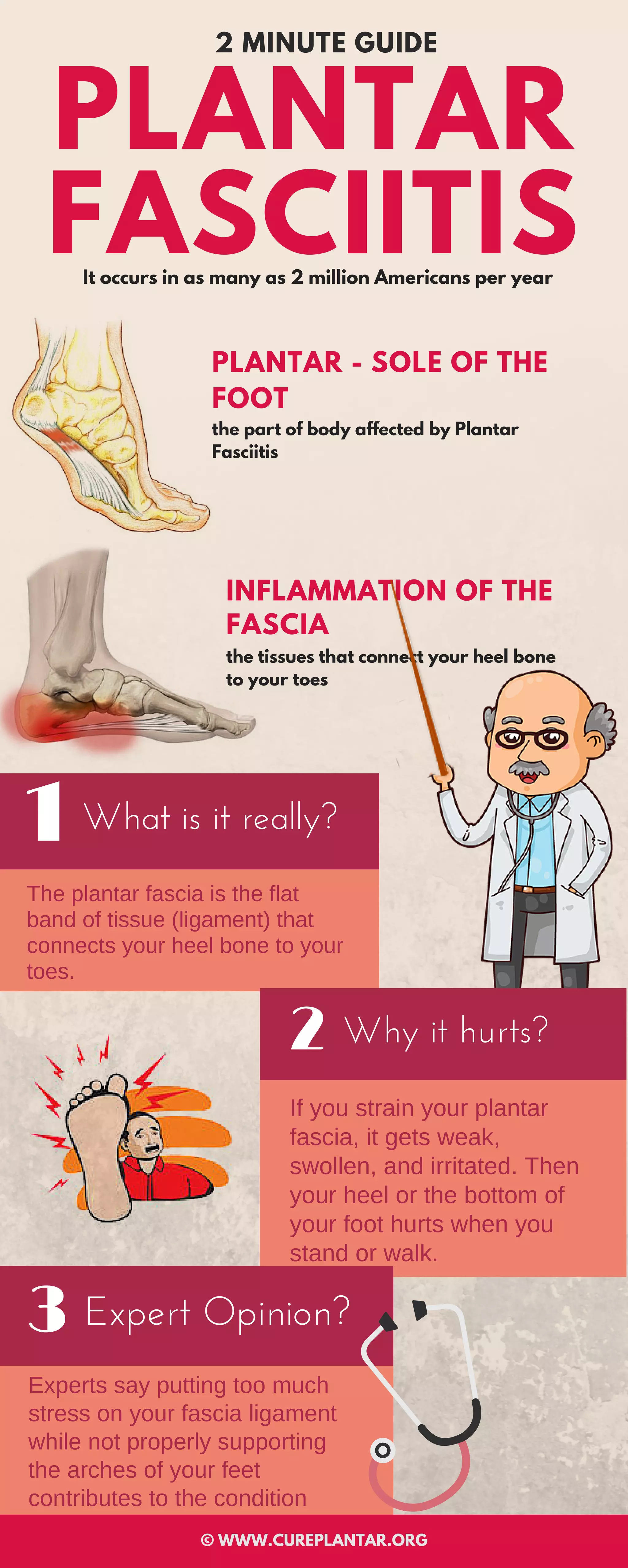 What's exactly plantar fasciitis - 2 Minute Guide | PDF