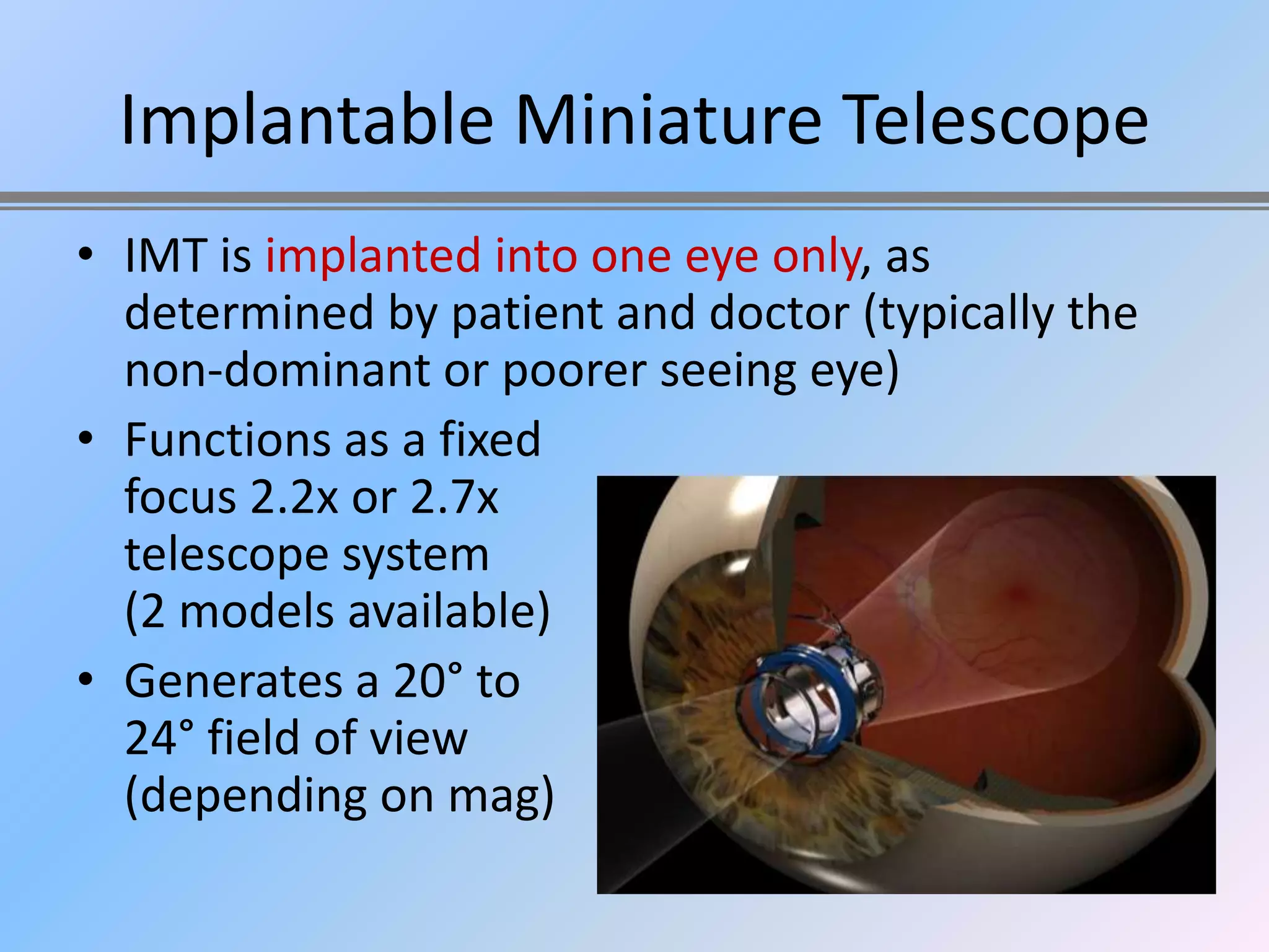 Implantable Miniature Telescope
• IMT is implanted into one eye only, as
  determined by patient and doctor (typically the
  non-dominant or poorer seeing eye)
• Functions as a fixed
  focus 2.2x or 2.7x
  telescope system
  (2 models available)
• Generates a 20° to
  24° field of view
  (depending on mag)
 