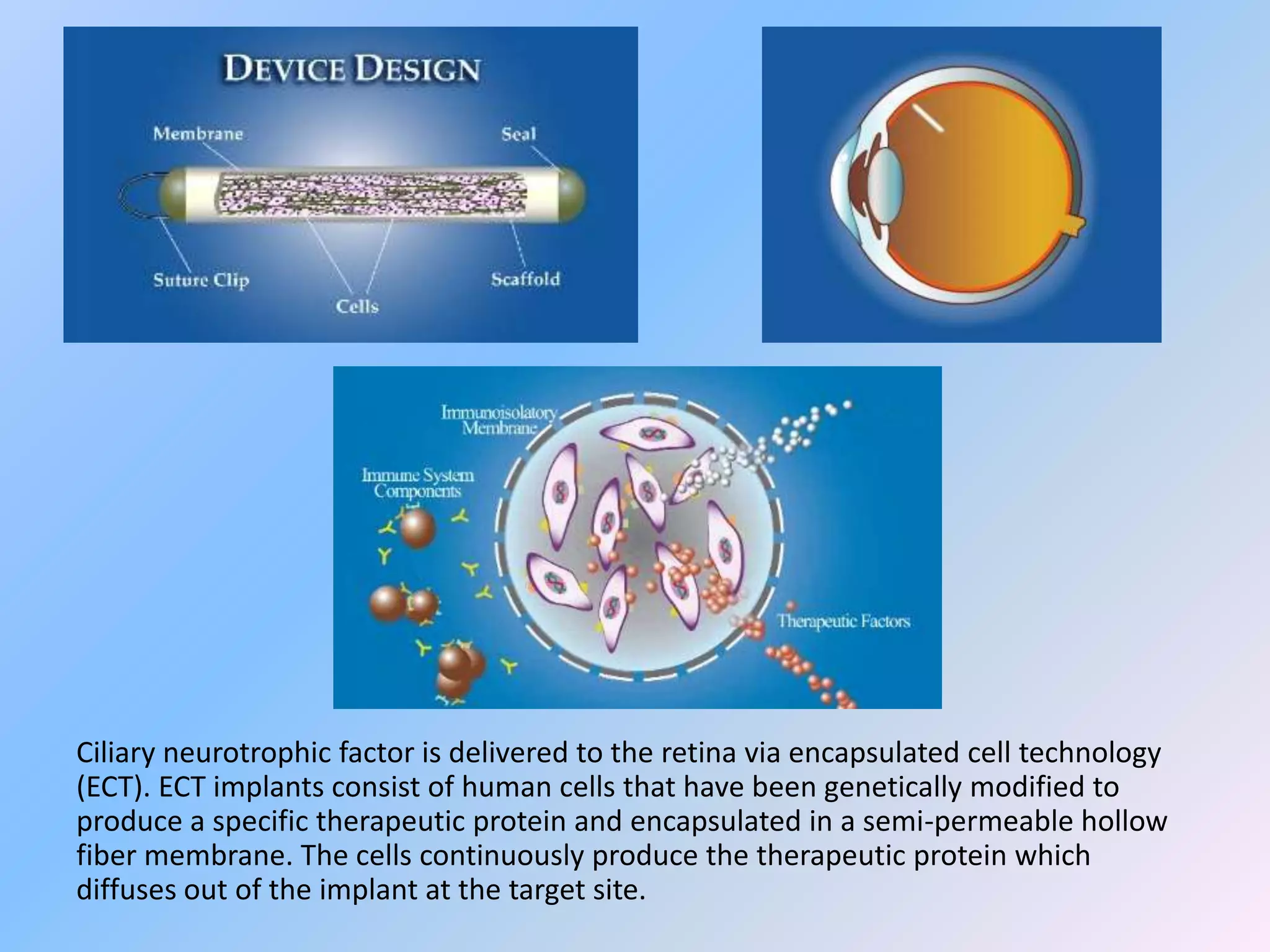 Ciliary neurotrophic factor is delivered to the retina via encapsulated cell technology
(ECT). ECT implants consist of human cells that have been genetically modified to
produce a specific therapeutic protein and encapsulated in a semi-permeable hollow
fiber membrane. The cells continuously produce the therapeutic protein which
diffuses out of the implant at the target site.
 