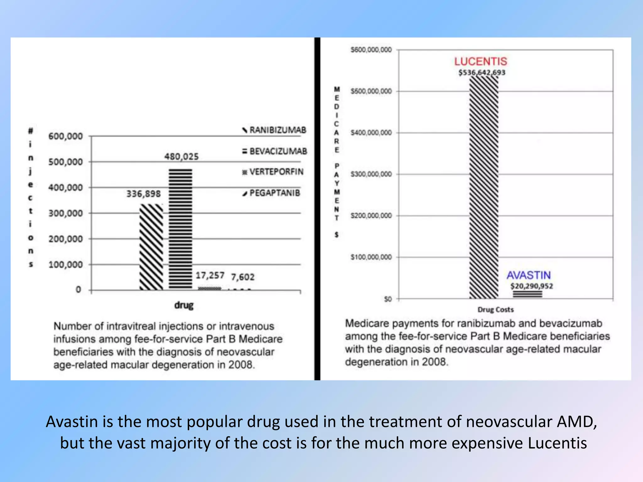 Avastin is the most popular drug used in the treatment of neovascular AMD,
  but the vast majority of the cost is for the much more expensive Lucentis
 