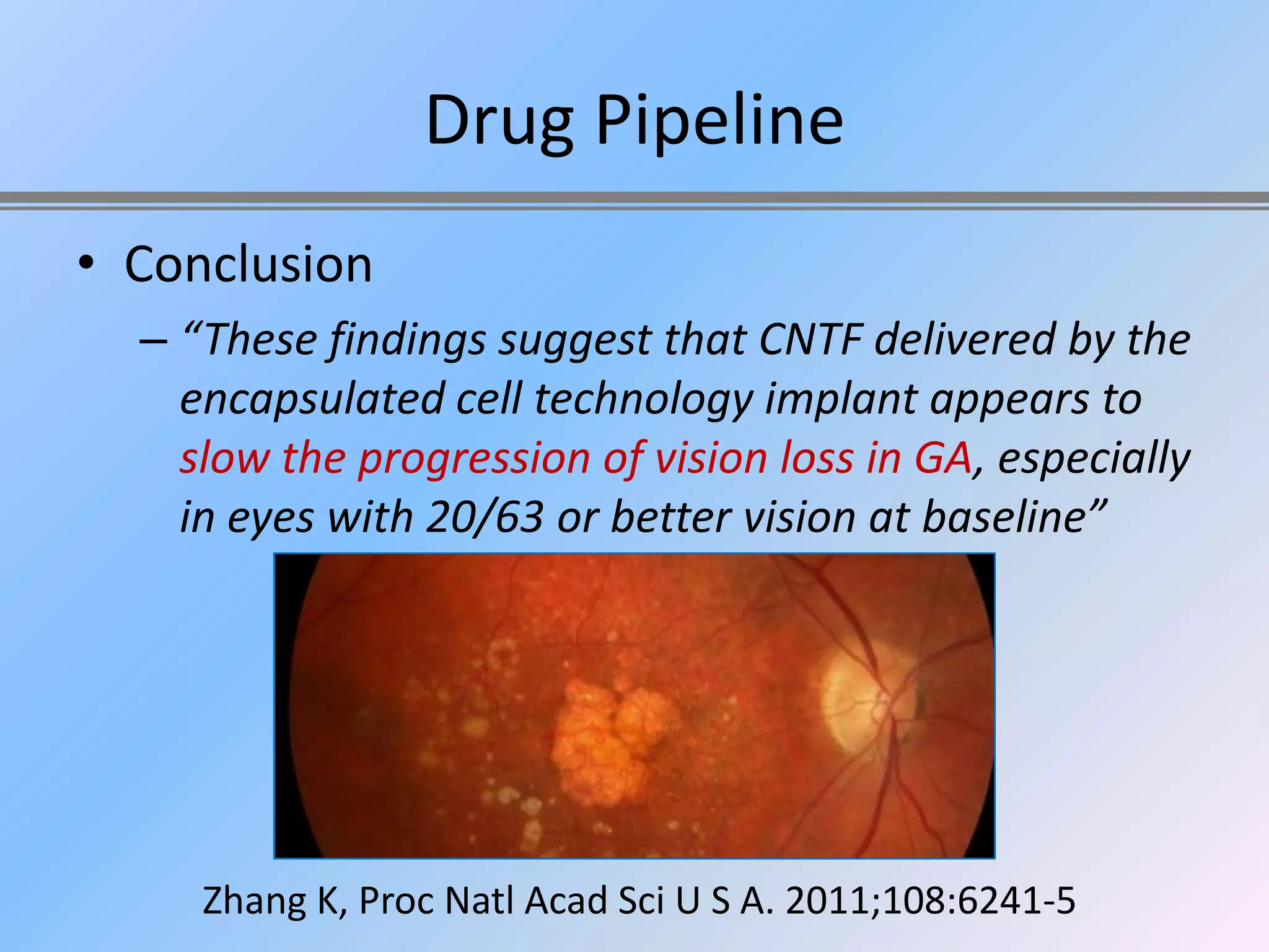 Drug Pipeline
• Conclusion
  – “These findings suggest that CNTF delivered by the
    encapsulated cell technology implant appears to
    slow the progression of vision loss in GA, especially
    in eyes with 20/63 or better vision at baseline”




     Zhang K, Proc Natl Acad Sci U S A. 2011;108:6241-5
 