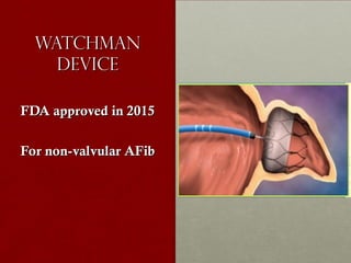 WatchmanWatchman
DeviceDevice
FDA approved in 2015FDA approved in 2015
For non-valvular AFibFor non-valvular AFib
 
