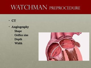 WatchmanWatchman preprocedurepreprocedure
• CTCT
• AngiographyAngiography
• ShapeShape
• Orifice sizeOrifice size
• DepthDepth
• WidthWidth
 