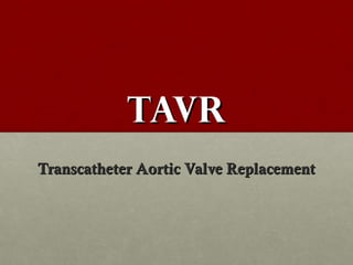 TAVRTAVR
Transcatheter Aortic Valve ReplacementTranscatheter Aortic Valve Replacement
 
