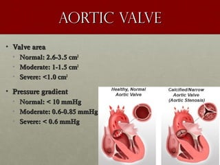 AORTIC valveAORTIC valve
• Valve areaValve area
• Normal: 2.6-3.5 cmNormal: 2.6-3.5 cm22
• Moderate: 1-1.5 cmModerate: 1-1.5 cm22
• Severe: <1.0 cmSevere: <1.0 cm22
• Pressure gradientPressure gradient
• Normal: < 10 mmHgNormal: < 10 mmHg
• Moderate: 0.6-0.85 mmHgModerate: 0.6-0.85 mmHg
• Severe: < 0.6 mmHgSevere: < 0.6 mmHg
 