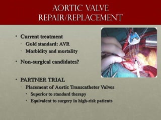Aortic valveAortic valve
Repair/replacementRepair/replacement
• Current treatmentCurrent treatment
• Gold standard: AVRGold standard: AVR
• Morbidity and mortalityMorbidity and mortality
• Non-surgical candidates?Non-surgical candidates?
• PARTNER TRIALPARTNER TRIAL
• Placement of Aortic Transcatheter ValvesPlacement of Aortic Transcatheter Valves
• Superior to standard therapySuperior to standard therapy
• Equivalent to surgery in high-risk patientsEquivalent to surgery in high-risk patients
 