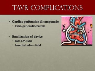 Tavr complicationsTavr complications
• Cardiac perforation & tamponadeCardiac perforation & tamponade
• Echo-pericardiocentesisEcho-pericardiocentesis
• Emolization of deviceEmolization of device
• Into LV- fatalInto LV- fatal
• Inverted valve - fatalInverted valve - fatal
 