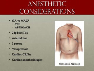 AnestheticAnesthetic
considerationsconsiderations
• GA vs MAC*GA vs MAC*
• TEETEE
• APPROACHAPPROACH
• 2 lg bore IVs2 lg bore IVs
• Arterial lineArterial line
• 2 pacers2 pacers
• VasopressorsVasopressors
• Cardiac CRNACardiac CRNA
• Cardiac anesthesiologistCardiac anesthesiologist
 
