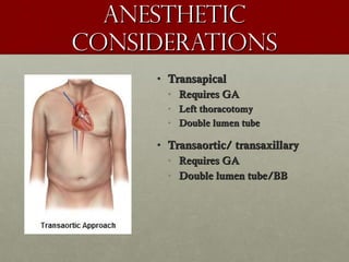 AnestheticAnesthetic
considerationsconsiderations
• TransapicalTransapical
• Requires GARequires GA
• Left thoracotomyLeft thoracotomy
• Double lumen tubeDouble lumen tube
• Transaortic/ transaxillaryTransaortic/ transaxillary
• Requires GARequires GA
• Double lumen tube/BBDouble lumen tube/BB
 