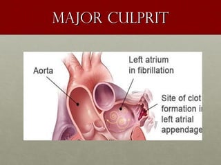 Major culpritMajor culprit
 