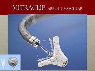 Mitraclip,Mitraclip, Abbott vascularAbbott vascular
 