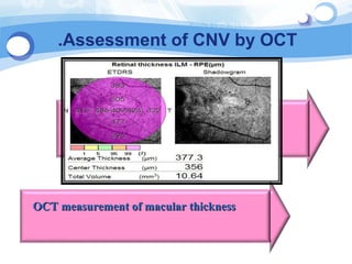 CNV updates | PPT