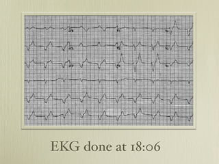 EKG done at 18:06
 
